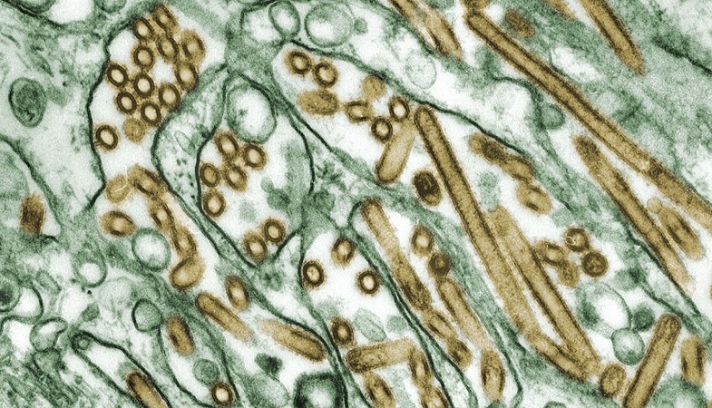 Monkeypox Virus May have Reached Australia Too